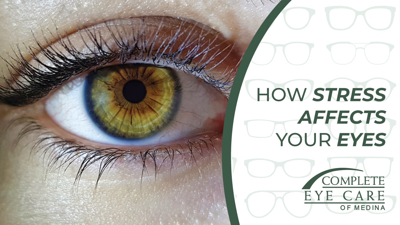 How Stress Affects Your Eyes